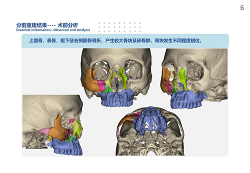 图片34.png 图片34.png