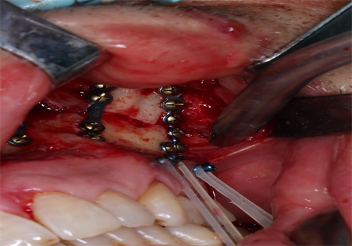 图片39.png 图片39.png